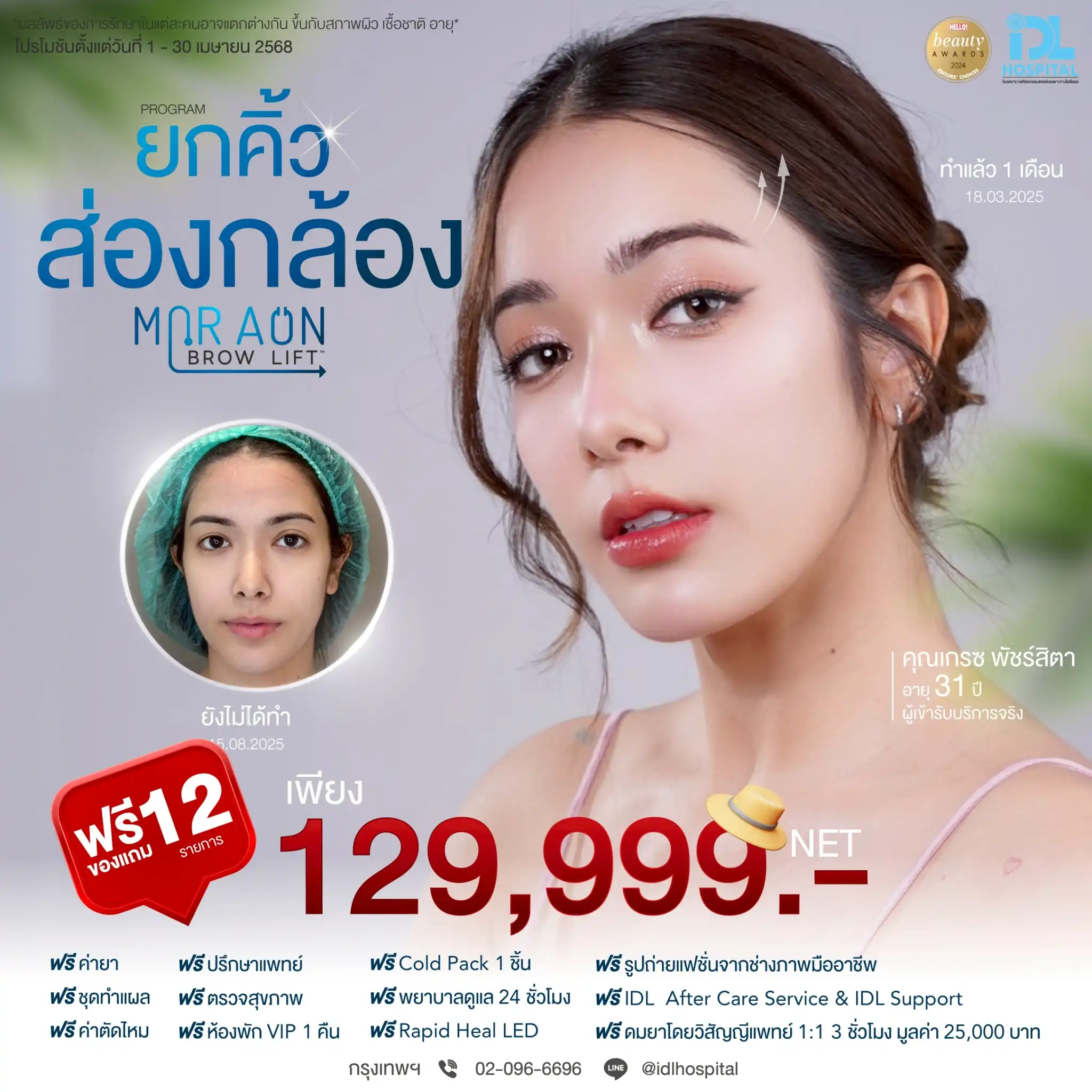 pro apr 25 ยกคิ้วส่องกล้อง