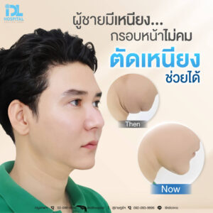 IDL_Aw14_230710