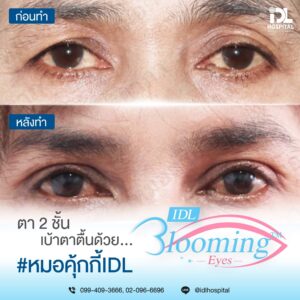 LINE_ALBUM_Blooming eyes หมอคุกกี้_231106_10