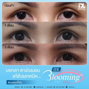 LINE_ALBUM_Blooming eyes หมอคุกกี้_231106_13