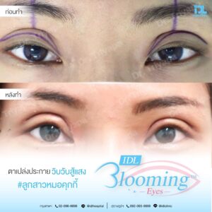 LINE_ALBUM_Blooming eyes หมอคุกกี้_231106_5