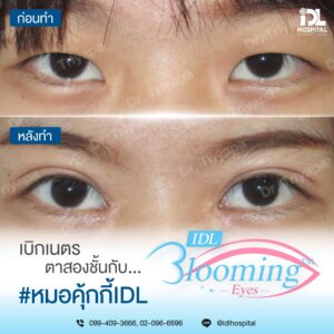 LINE_ALBUM_Blooming eyes หมอคุกกี้_231106_9