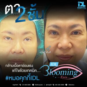 LINE_ALBUM_Blooming eyes หมอคุกกี้_231216_1