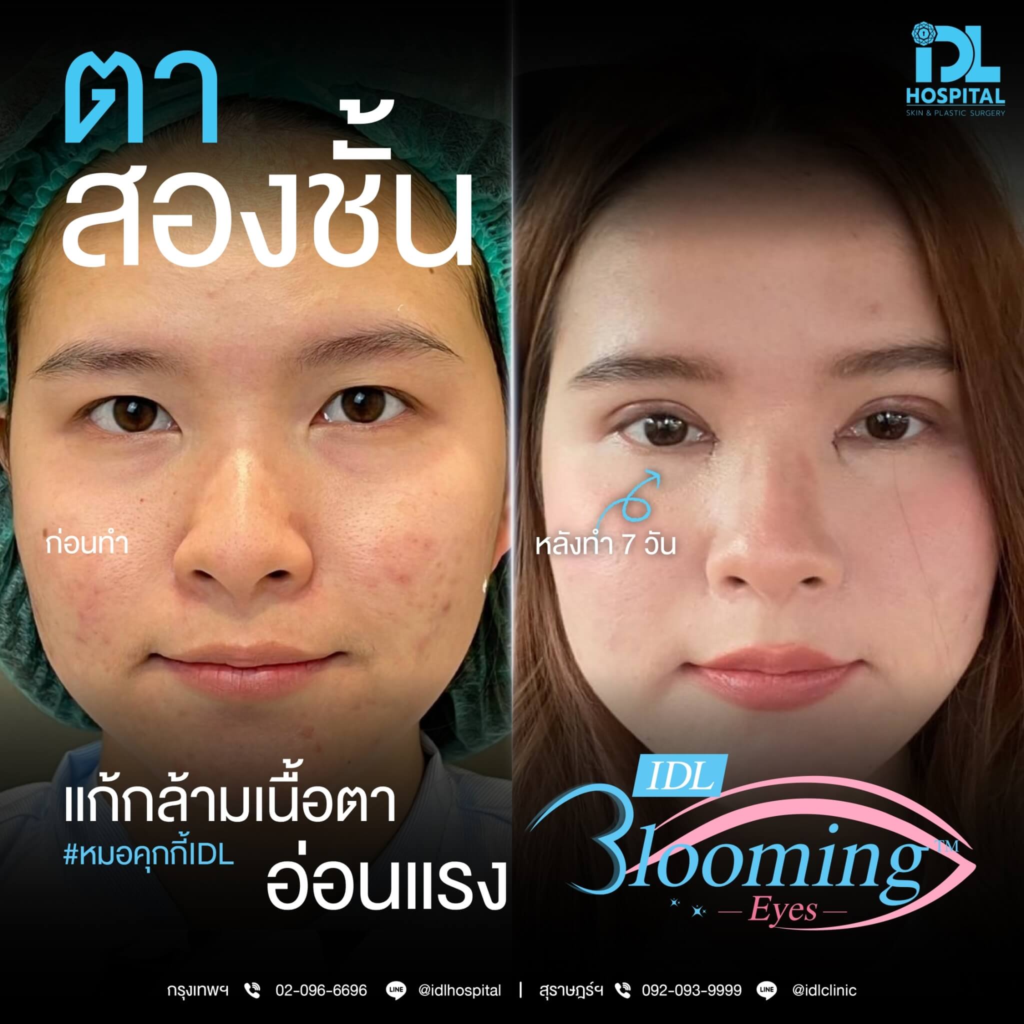 LINE_ALBUM_Blooming eyes หมอคุกกี้_231216_10
