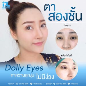 LINE_ALBUM_Blooming eyes หมอคุกกี้_231216_8