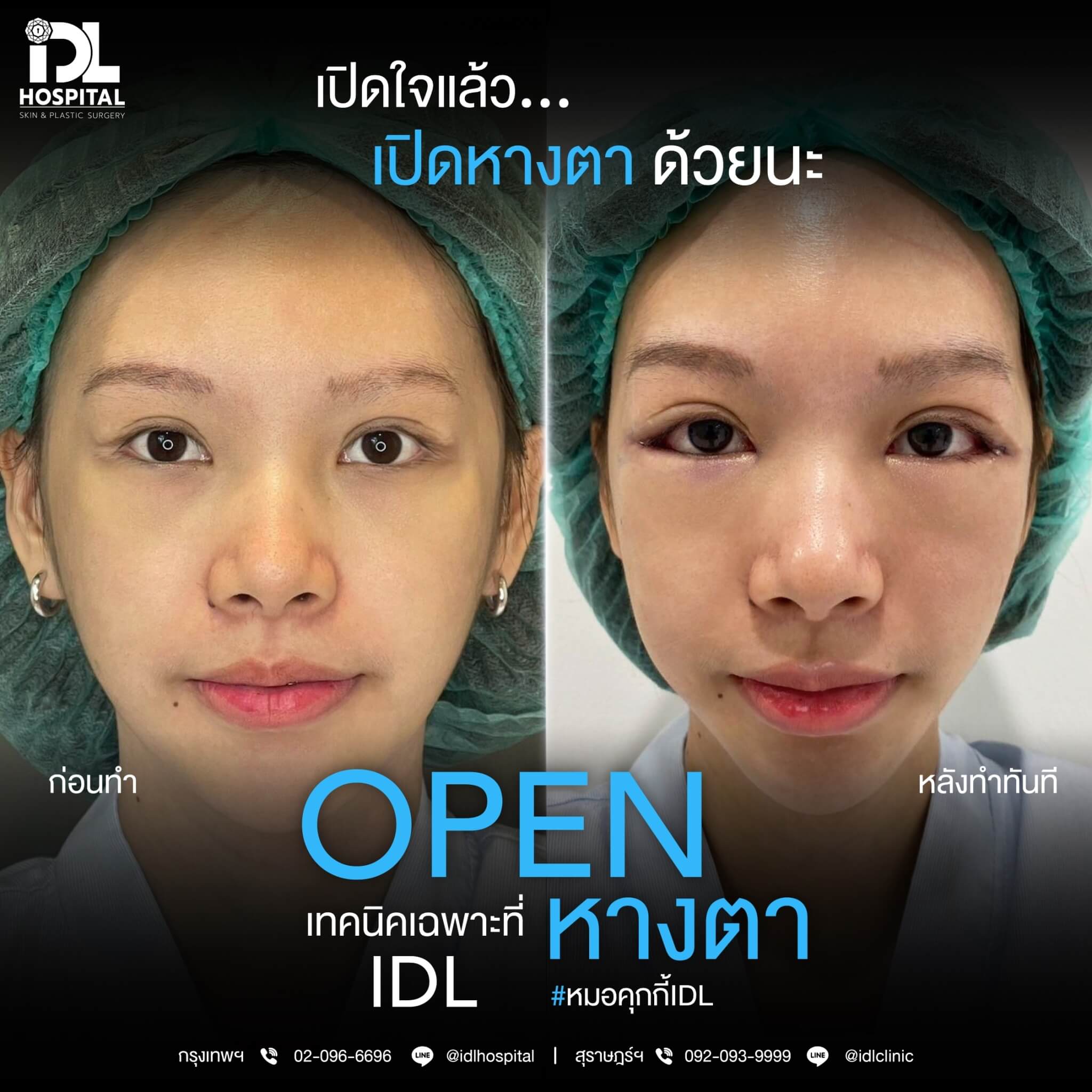 LINE_ALBUM_Blooming eyes หมอคุกกี้_231216_9