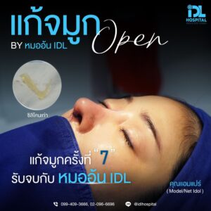 จมูก open