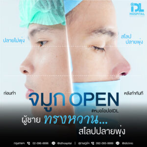 จมูก open