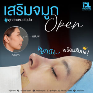 จมูก open