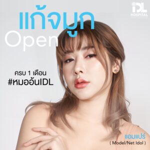จมูก open