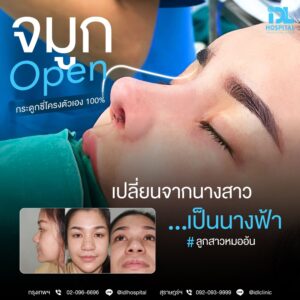 จมูก open