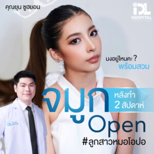 จมูก open