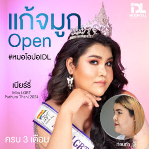 จมูก open