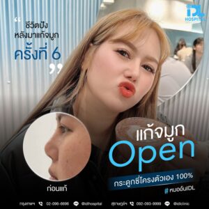จมูก open