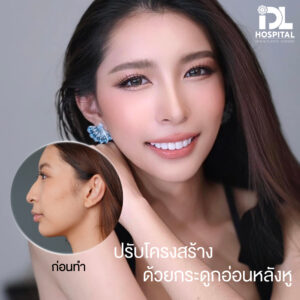 จมูก open