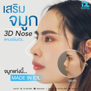 3D nose