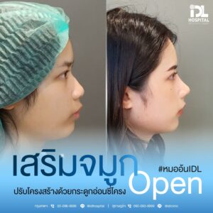 จมูก open