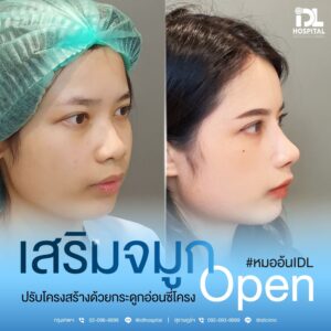 จมูก open