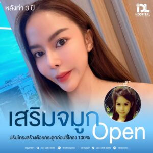 จมูก open