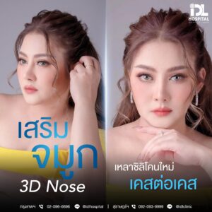 3D nose