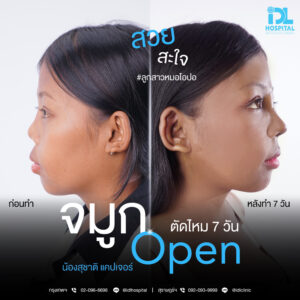 จมูก open