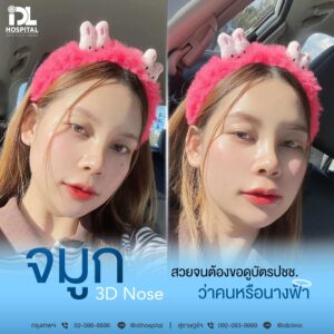 3D nose