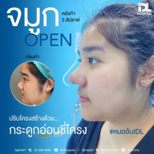 จมูก open