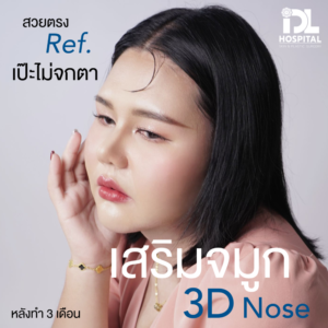 3D nose