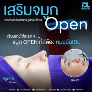 จมูก open