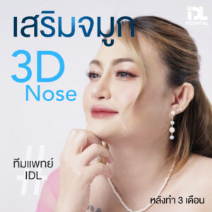 3D nose