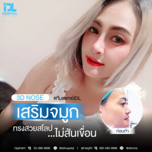3D nose