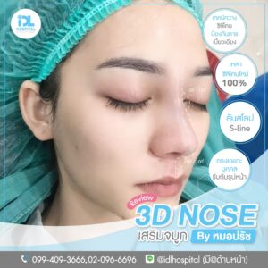 3D nose