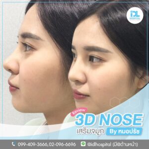 3D nose