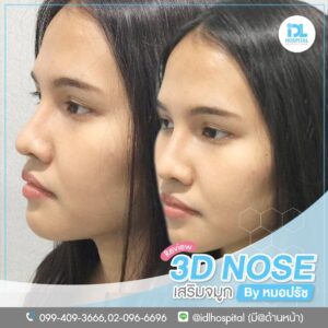 3D nose