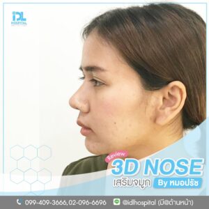 3D nose