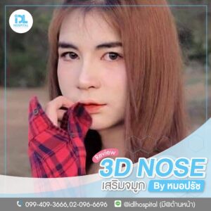 3D nose
