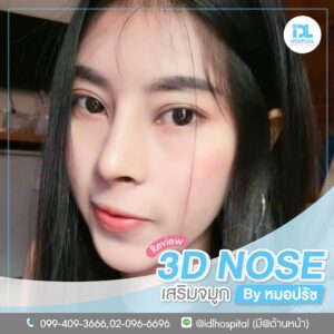 3D nose