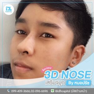 3D nose