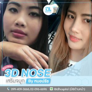 3D nose