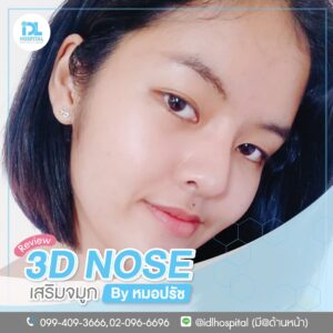 3D nose