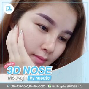 3D nose