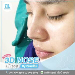 3D nose