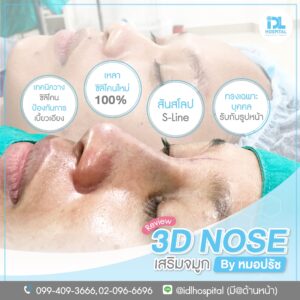 3D nose