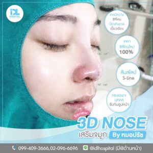 3D nose
