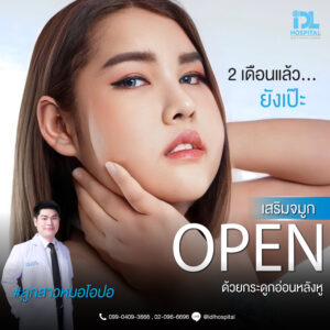 จมูก open