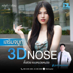 3D nose