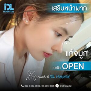 จมูก open