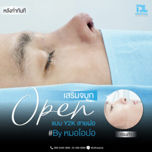 จมูก open