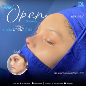 จมูก open