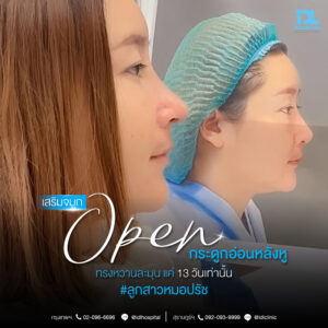 จมูก open